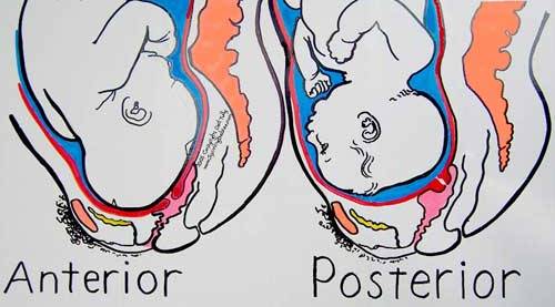 baby-in-posterior-position-births-my-pregnant-health